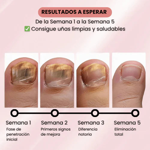 PARCHES ANTI-HONGOS PARA UÑAS