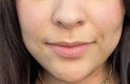 Antes